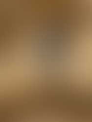 JERUZALEM | SHKALLA OBJEKT MOSMARRËVESHJESH MES KISHAVE; ËSHTË DOKUMENTUAR NË GRAVURA NGA FILLIMI I SHEKULLIT TË 18-të.