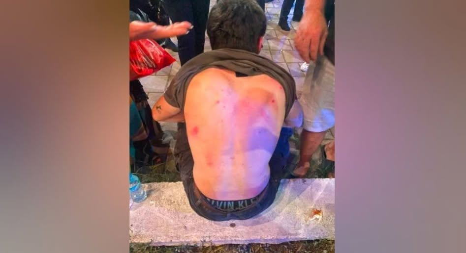 TIRANË | DISA QYTETARË ITALIANË U BËNË OBJEKT SULMI VERBAL DHE FIZIK NË MES TË TIRANËS NGA SUBJEKTE QË I PËRKASIN KLASËS SHOQËRORE TË HALABAKËRISË.