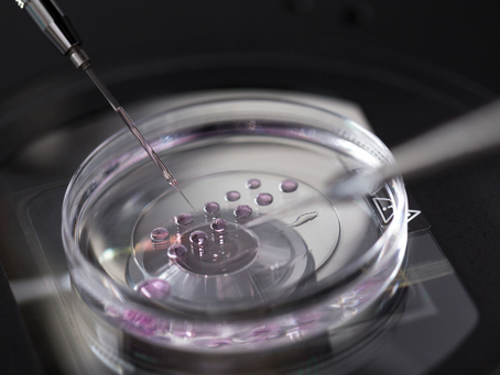In Vitro Fertilization