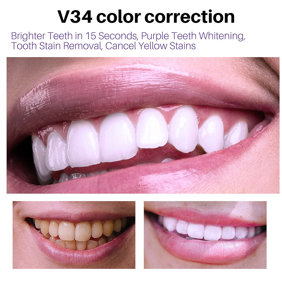 Thumbnail: Lanthome V34 Teeth Whitening Mousse for Oral Care