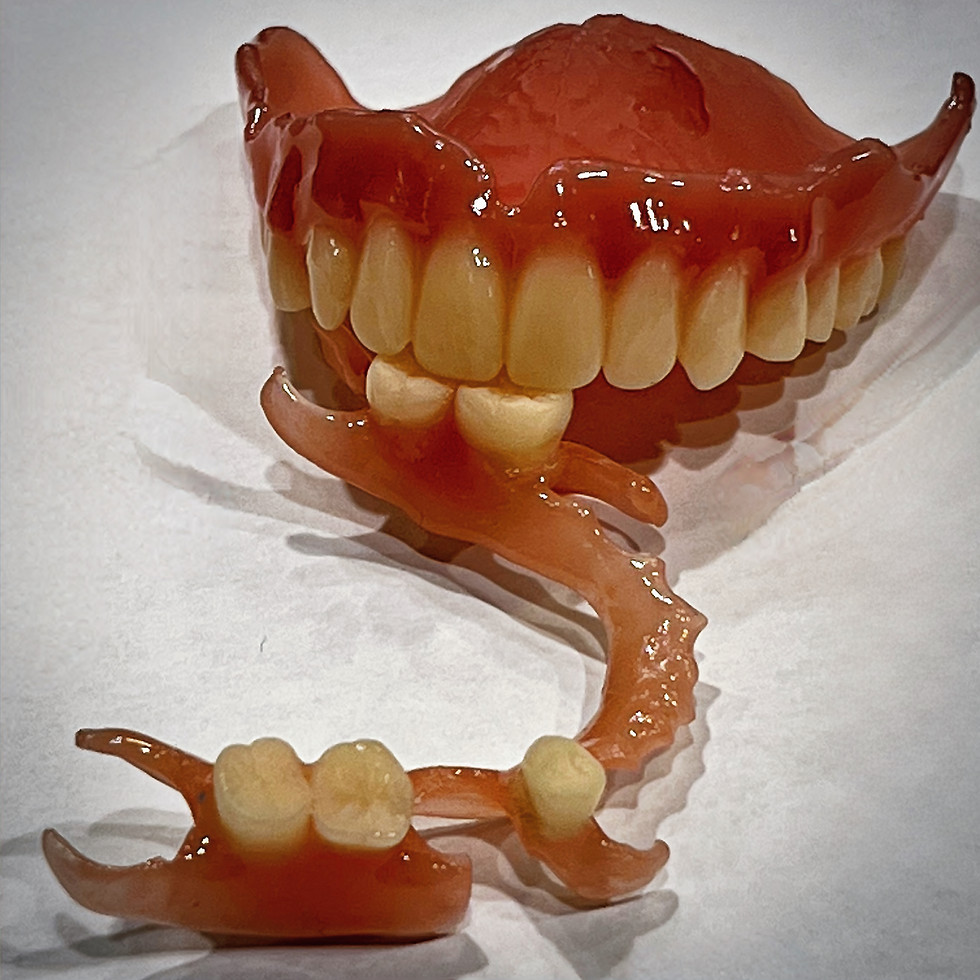 Complete set of dentures, upper and lower, resting on a white surface.