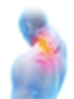 neckpainanatomical18070972_m