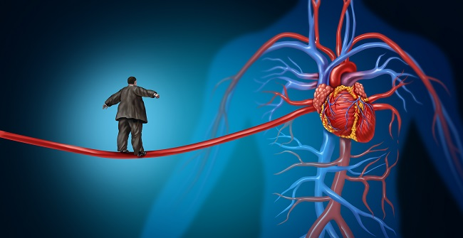 Why Classifying Your Cardiovascular Risk Is Essential