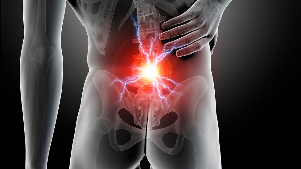 Failed Back Syndrome