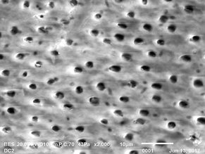 “But Isn’t a Tooth Full of Bacteria?” Here’s Why the Graft Isn’t