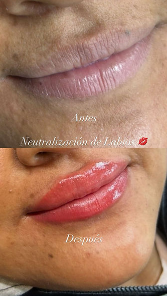 labios neutralizacion.jpeg