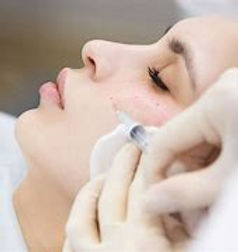 Nappage Mesotherapy - Needle
