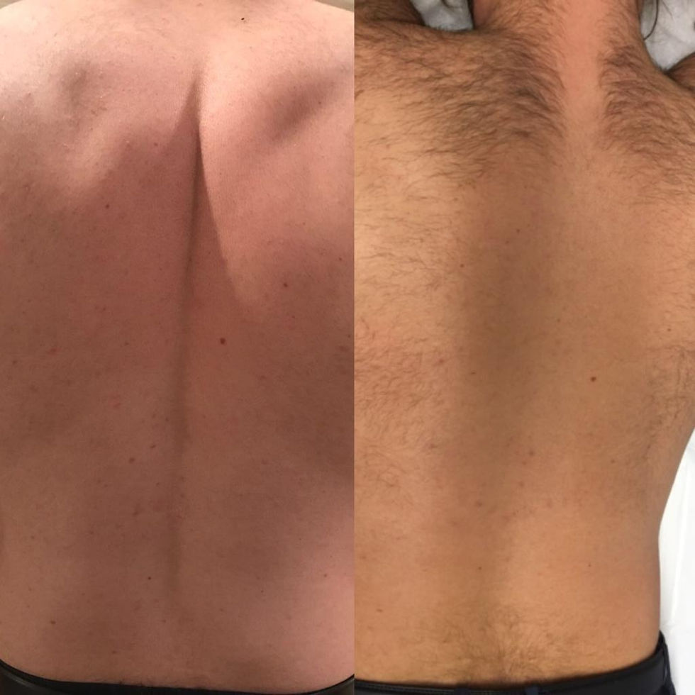 Laser hair removal waddington, Lincoln (10)
