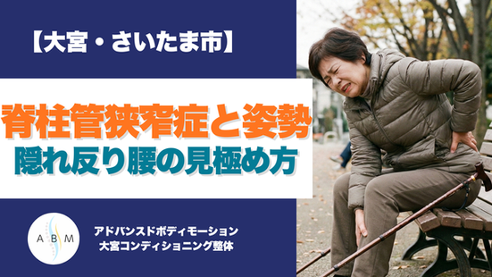 脊柱管狭窄症の痛みと姿勢の関係|大宮コンディショニング整体が教える隠れ反り腰の見極め方のアイキャッチ