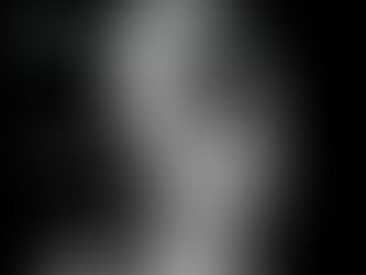 Scheuermann's Disease