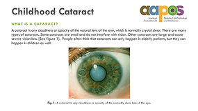 thumbnail_cataract_edited.jpg