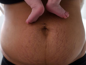 Postpartum Recovery