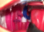 Thumbnail: Oesophageal atresia and tracheo-oesophageal fistula repair