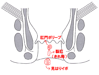 IMG_0331.GIF