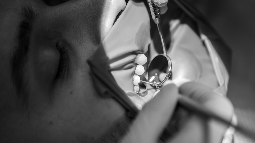 Pacient stând pe scaunul dentistului, gura deschisă, cu un scut bucal și oglindă dentară. Imaginea alb-negru, detalii dentare vizibile.