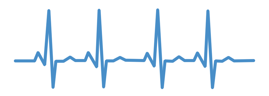 ekg gif.gif