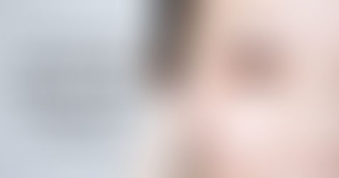 3 Cara untuk Mengurangkan Keletihan Mata Sekarang