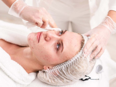 Pimple Treatment in Mumbai
