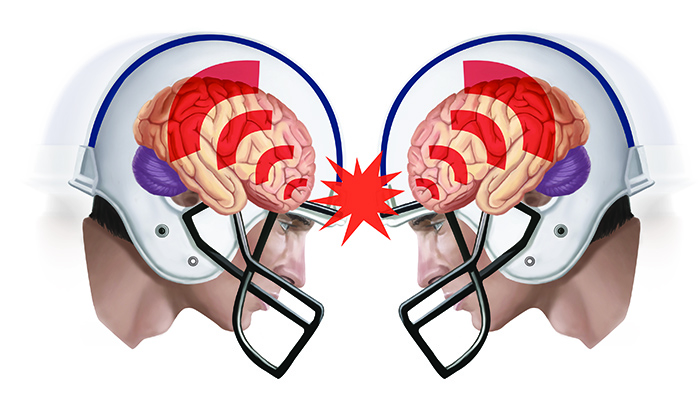 The Changing Landscape of High School Football in Alabama-Player Safety and Legal Concerns article cover