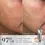 Thumbnail: MEDIK8 CRYSTAL RETINAL®
