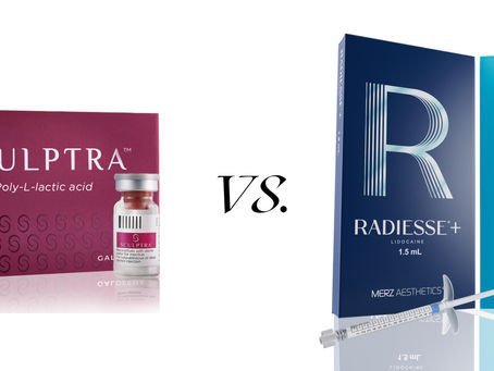Sculptra vs Radiesse comparison showing collagen stimulation, volume restoration and skin tightening at ALBA Skin & Beauty Clinic