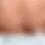 Thumbnail: MEDIK8 PRESS & CLEAR™