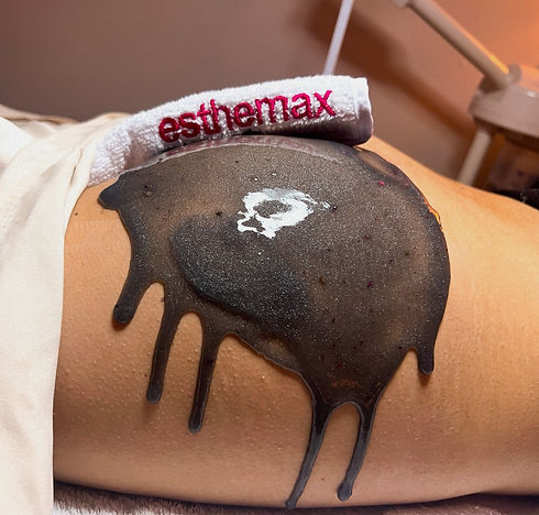 esthe max butt pic_edited_edited.jpg