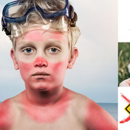 Keeping Summer Fun With Must Have Remedies.