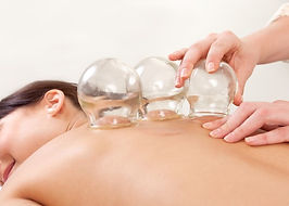 Cupping Therapy (5).jpg