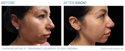 Exion_PIC_Ba-card-face-female-071_FRF_ENUS100.png