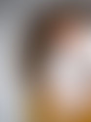 How to Treat Natural Tears