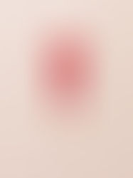 Primary Postpartum Hemorrhage