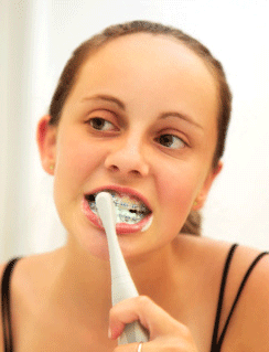 Flossing, Brushing, and Beyond: How to Care for Teeth with Braces