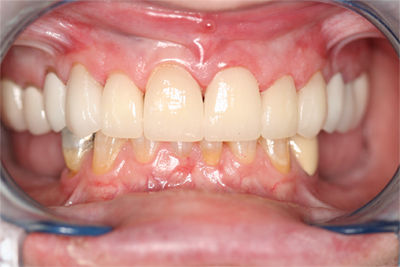 Patient 7 After