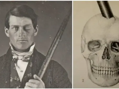 The Railroad worker who changed Neuroscience