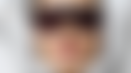 Depilacja laserowa LightSheer – dlaczego ten laser wygrywa wszystko?