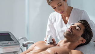 Depilacja laserowa dla mężczyzn – coraz popularniejszy trend