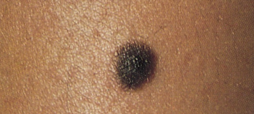 Black Dermatologist Directory, Derm, Black Skin Dermatology, Black Derm Skin Experts, African American Dermatologist, Skin of Color Dermatology