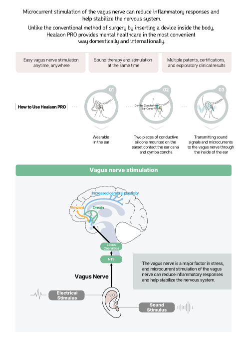 Thumbnail: Healaon Pro - Vagus Nerve and Sound stimulation - Tinnitus