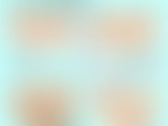 美容鍼のメリット②