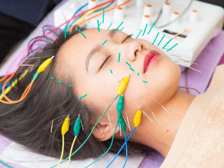 【美容専門鍼灸院】しらゆき堂鍼治療院とは？