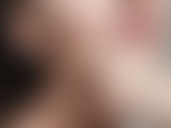 【レチノール配合化粧品で美肌になれるの?】