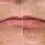 Thumbnail: before and after topical lip filler 