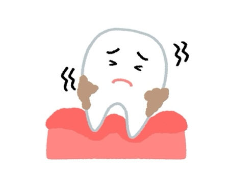 歯周病のセルフチェック❗️