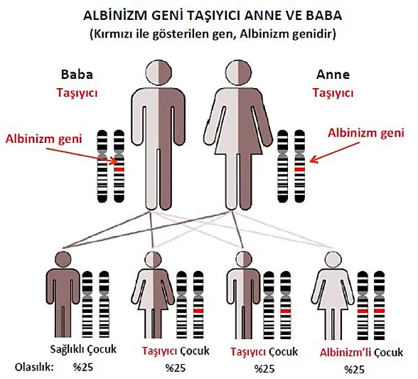 Genetik Albinizmdernegi