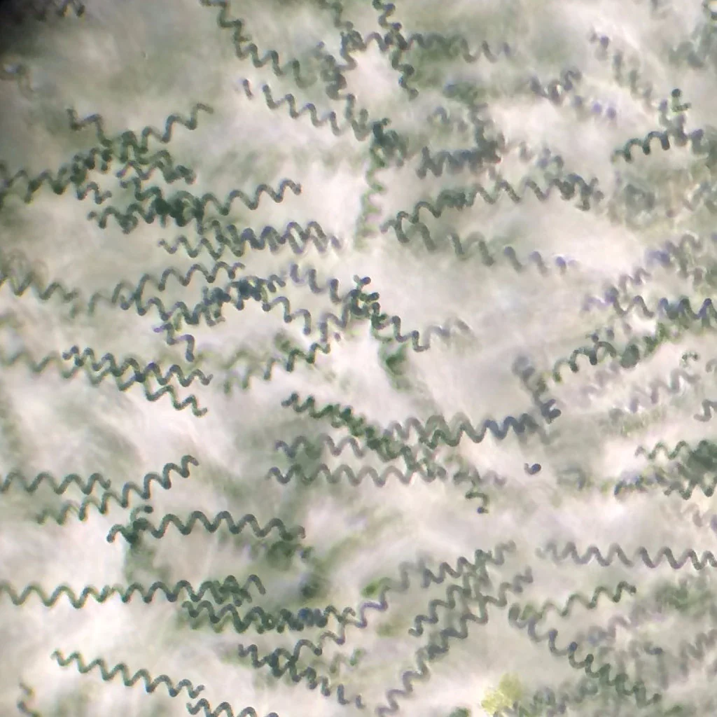 spirulina-1_2000x.jpeg.webp