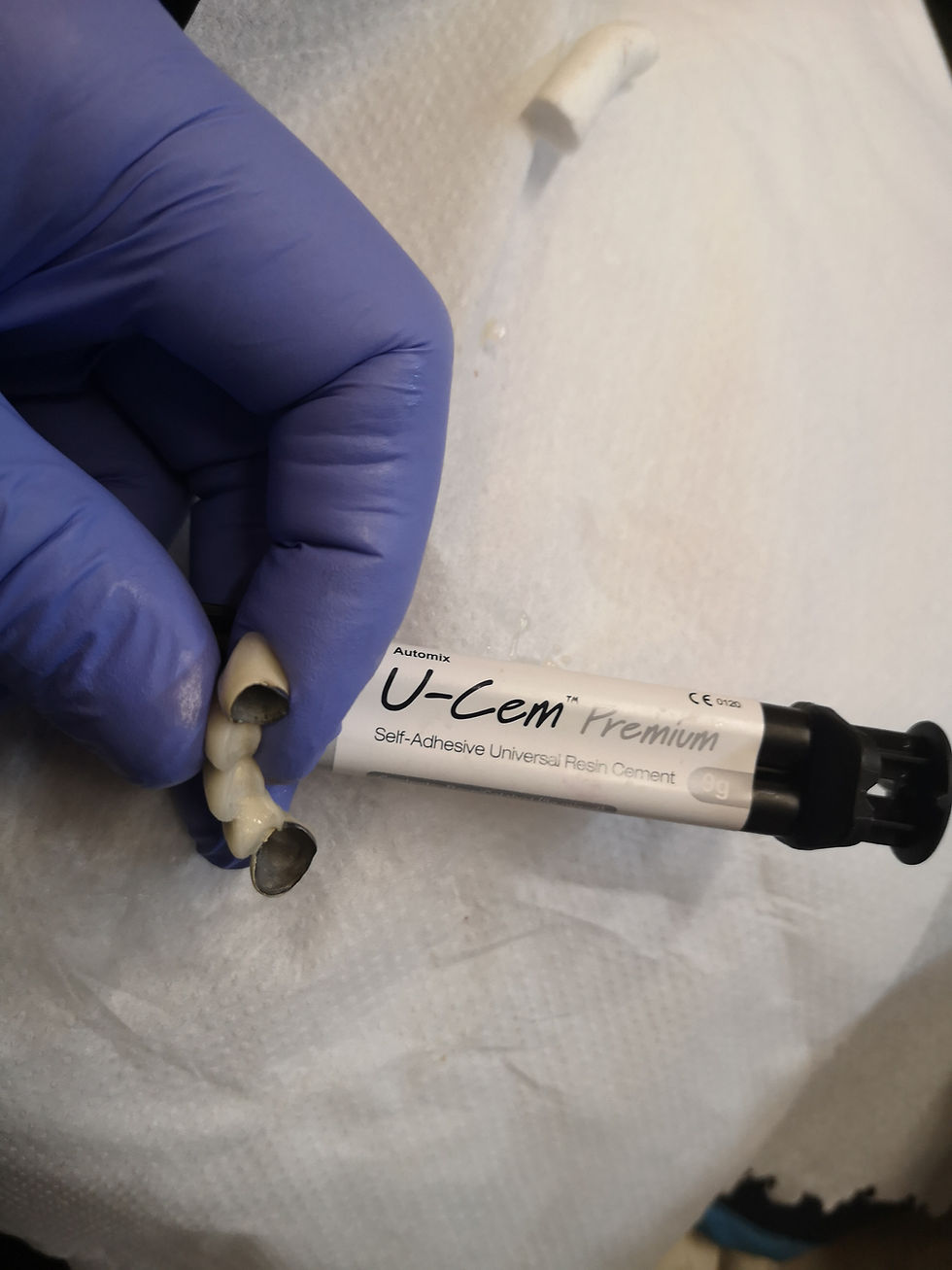 Thumbnail: U-CEM PREMIUM Dual Cure Cement