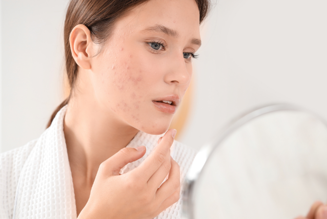 Woman looking unhappy at her skin in handheld mirror due to breakouts and dull complexion