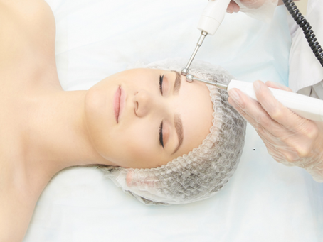 Lady having a ultra visage non surgical face lift facial