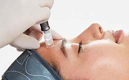 9x16 Microneedling - Model _edited.jpg